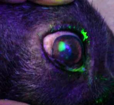 Та же эрозия роговицы после окрашивания флюоресцином в ультрафиолетовом свете.