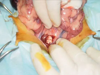 Аденокарцинома правого надпочечника у хорька в ходе операции