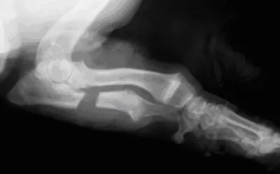 Рентгенограмма той же собаки после коррегирующей остеотомии